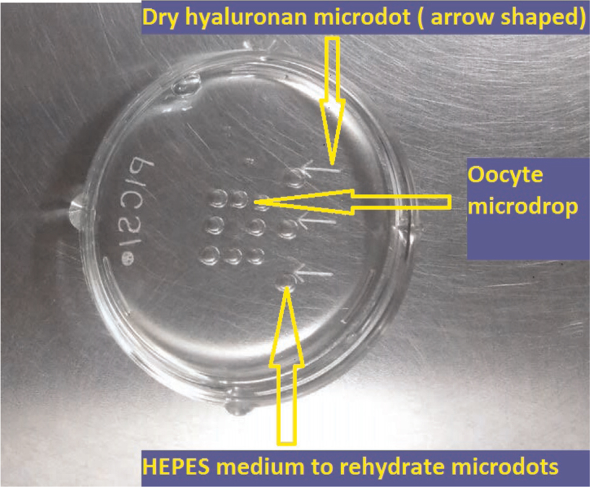 Preparation of physiological intracytoplasmic sperm injection dish: one 5 µl drop of polyvinylpyrrolidone for priming the injection pipette in the centre of oocytes micro drop. Three tail shaped 5 µl drops to rehydrate dry hyaluronan microdots; 5 µl HEPES drops for keeping the oocytes during ICSI. The number of HEPES drops depends on the number of oocytes to be injected. Everything is covered under oil