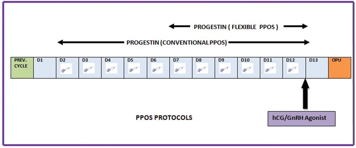 Progestin Primed Ovarian Stimulation Protocol