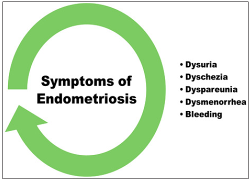 Symptoms of endometriosis.