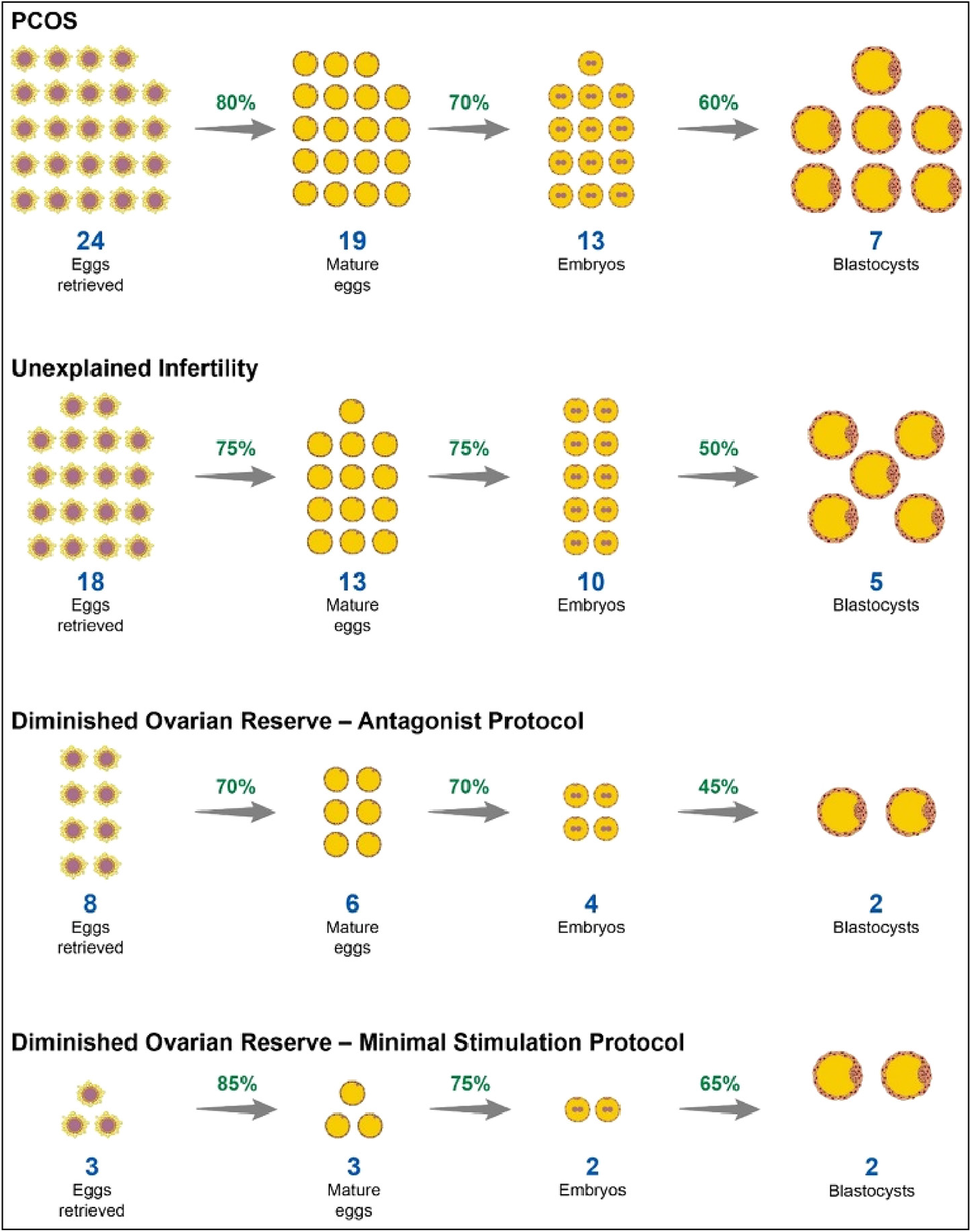 IVF attrition counseling diagram based on ovarian reserve. IVF: In vitro fertilisation, PCOS: Polycystic ovarian syndrome